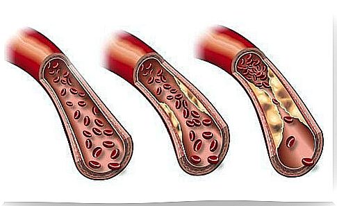 A sample weekly menu to lower triglycerides