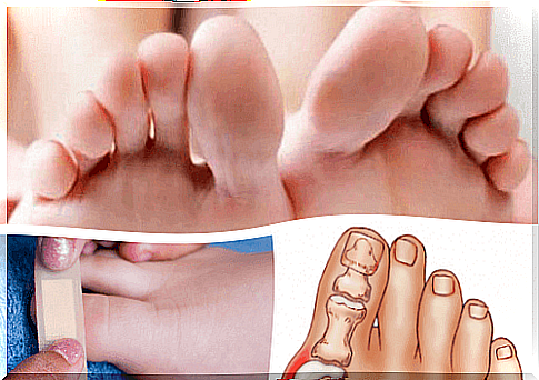 All about toe and foot conditions