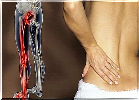 Exercises to get rid of sciatic nerve pain