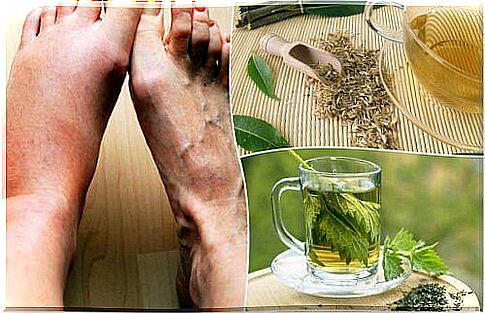 Five home remedies for lower uric acid levels