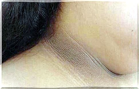 Four remedies to lighten dark discolorations in your neck