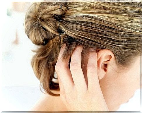 head lice;  natural remedies.