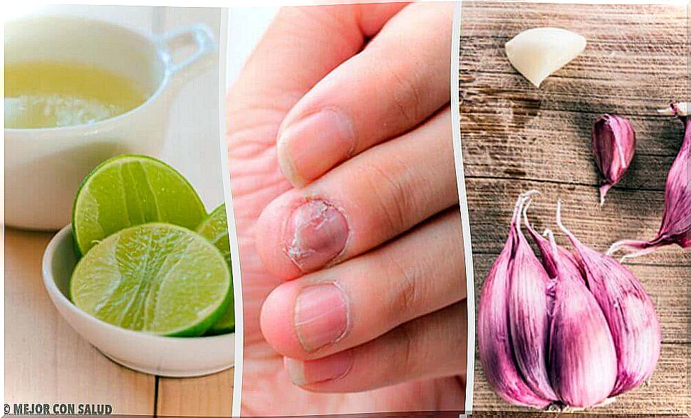 Home remedies for fungal nails