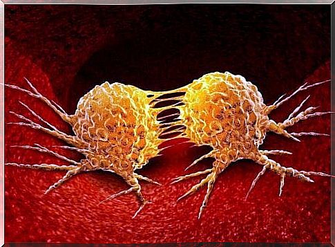 An image of cancer cells