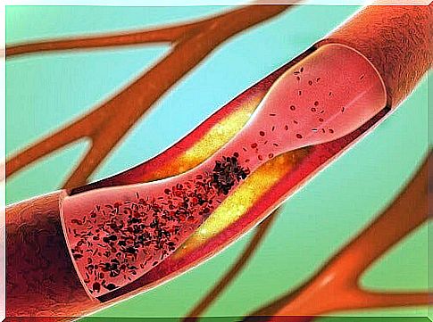 Keeping the arteries healthy: how do you do that?