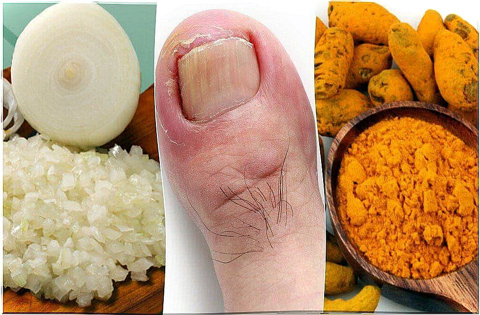 Make these 6 remedies for an inflamed hangnail yourself