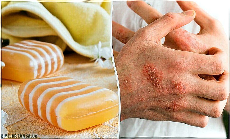 Make your own: soap against eczema, from glycerine, propolis and clay