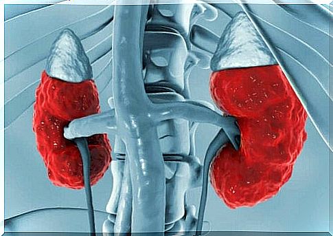 Managing Chronic Kidney Disease