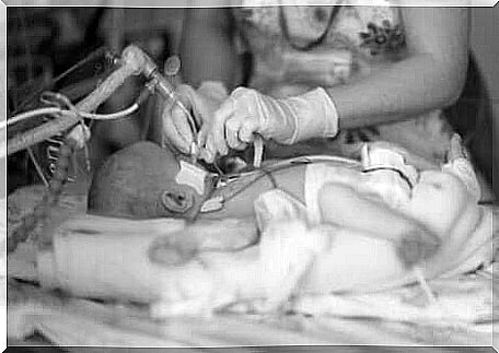 A baby with neonatal breathing problems