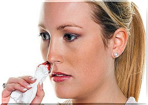 Natural remedies for nosebleeds