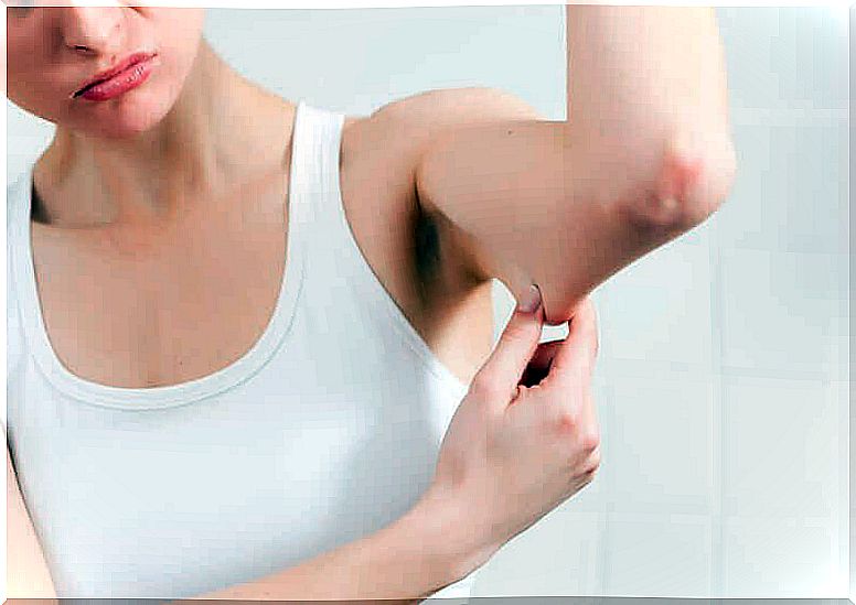 Prevent sagging skin, for example under the arms