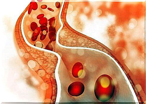 Cholesterol in blood stream