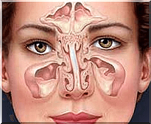 Symptoms of Sinusitis: From Cause to Diagnosis