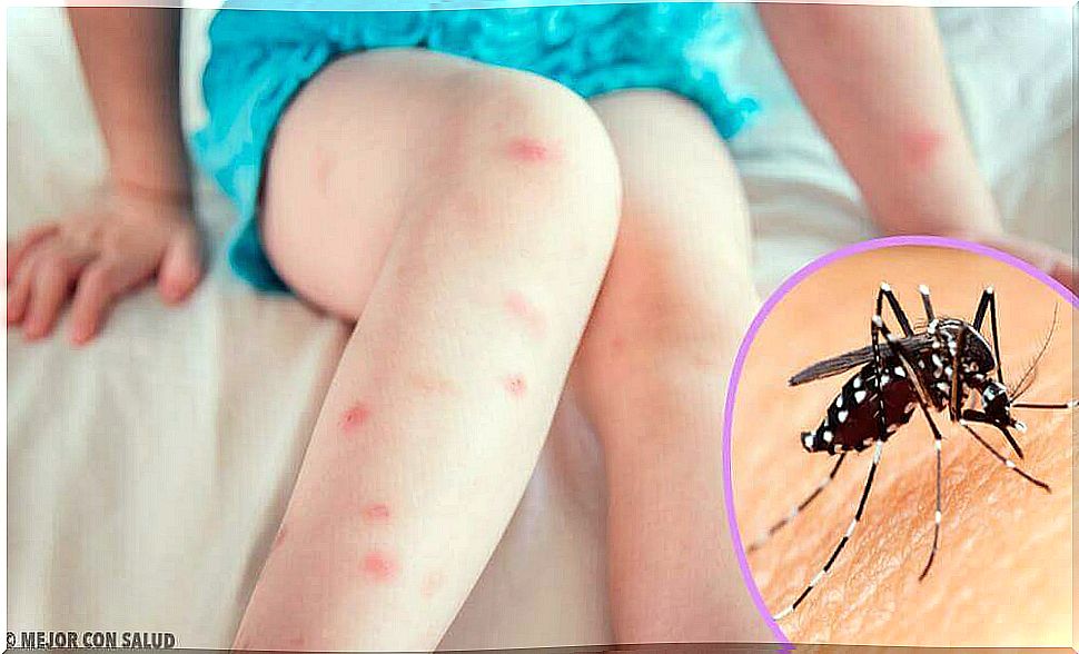 The 5 most common insect bites