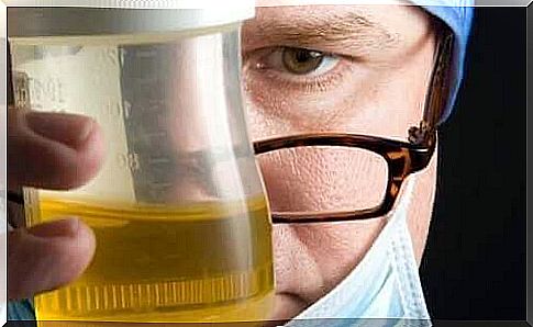 A doctor holding a urine sample