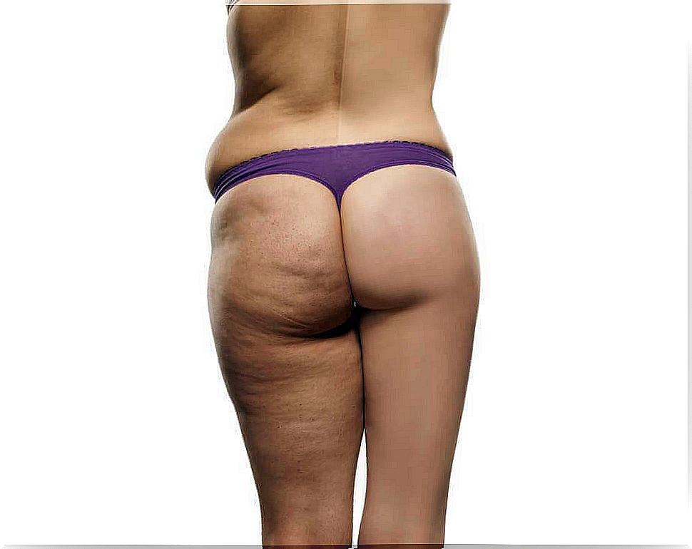 The perfect anti-cellulite diet plan for you