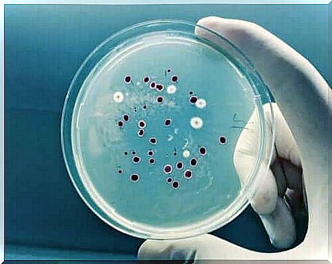 Petri dish with a culture