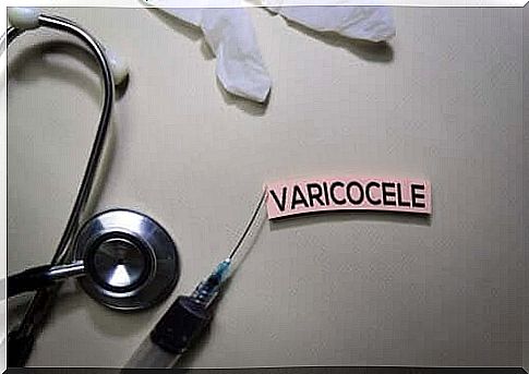 What you need to know about varicocele